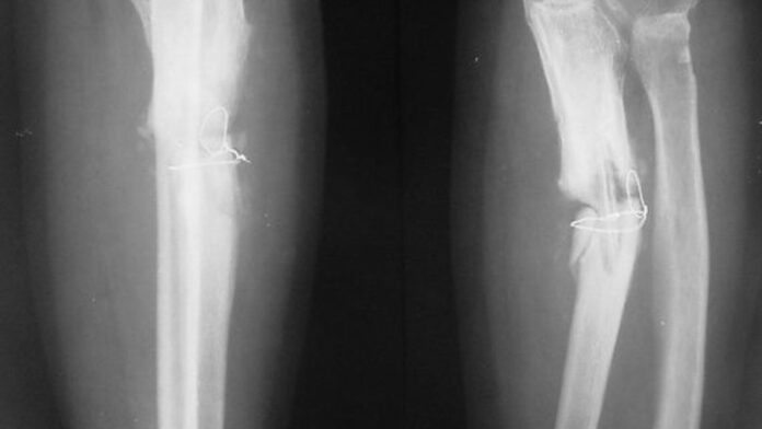 f5d68857aadb8a007fb215e16491585c