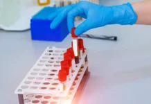 „Sângele de aur”, grupa sangvină pe care doar 50 de oameni din lume o au. Cercetătorii au acum o misiune contra cronometru