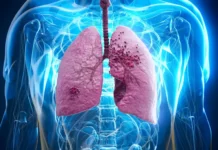 Cancerul – boala care poate recidiva după ani de zile. Vinovate sunt celulele tumorale „adormite”