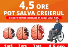 Ce este „fereastra terapeutică” în cazul unui AVC?