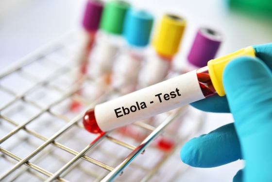 990a848f8f3e33210195d64d3ffc574d_ebola_6a0bf39266d2c